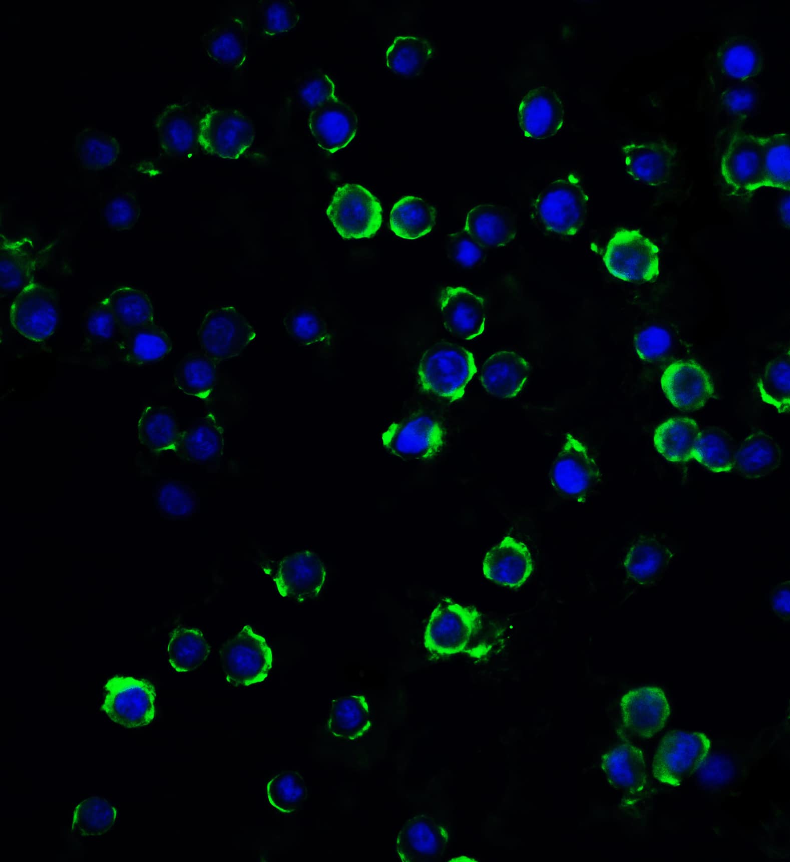 Immunocytochemistry/ Immunofluorescence: MAGEA4 Antibody - BSA Free [NBP2-41318] - Immunofluorescence of MAGEA4 inHeLa cells with MAGEA4 antibody at 20 u/ml.Red: MAGEA4 Antibody   Blue: DAPI staining