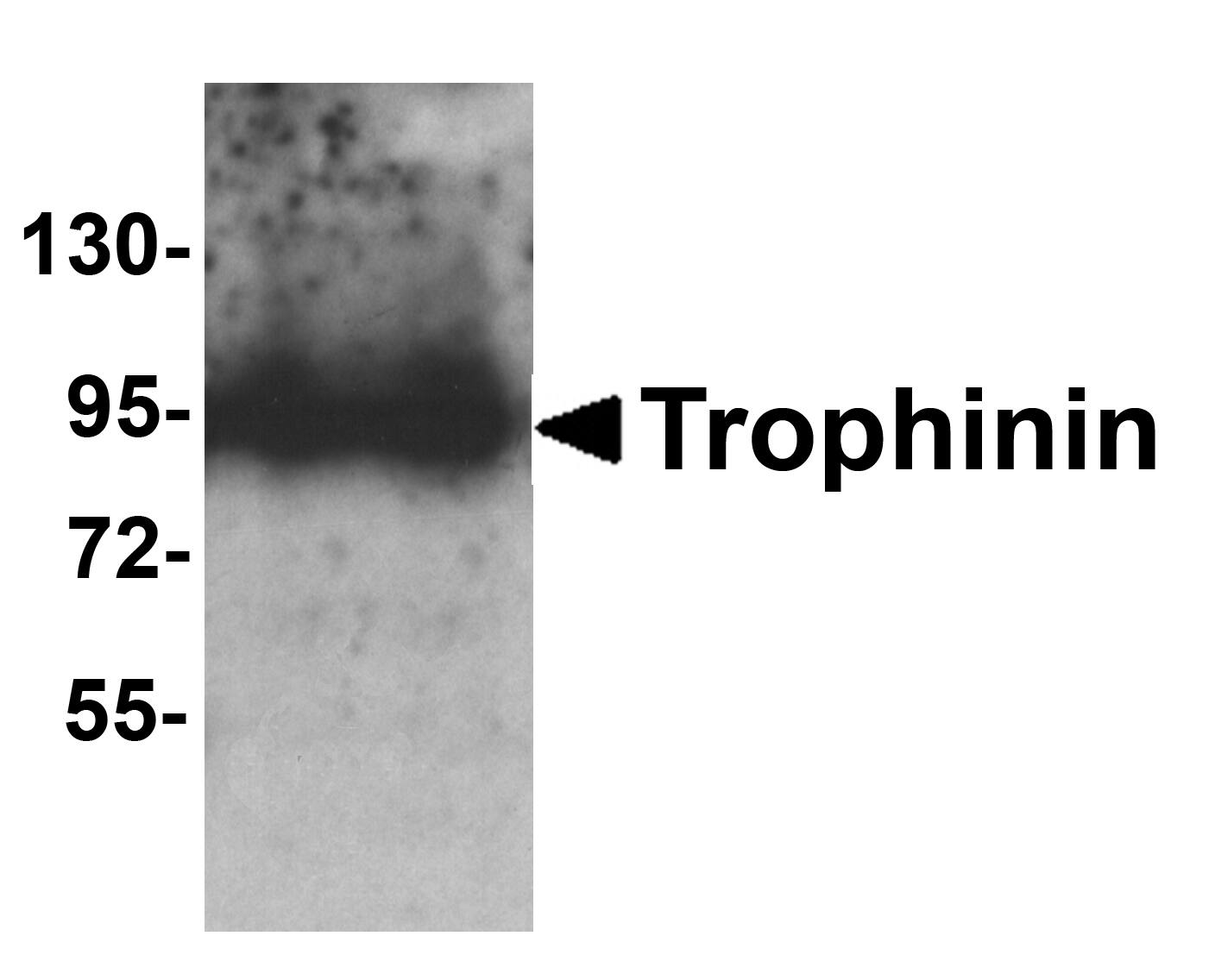 Western Blot: Trophinin Antibody - BSA Free [NBP2-41320] - Western blot analysis of Trophinin in rat liver tissue lysate with Trophinin antibody at 1 u/ml.