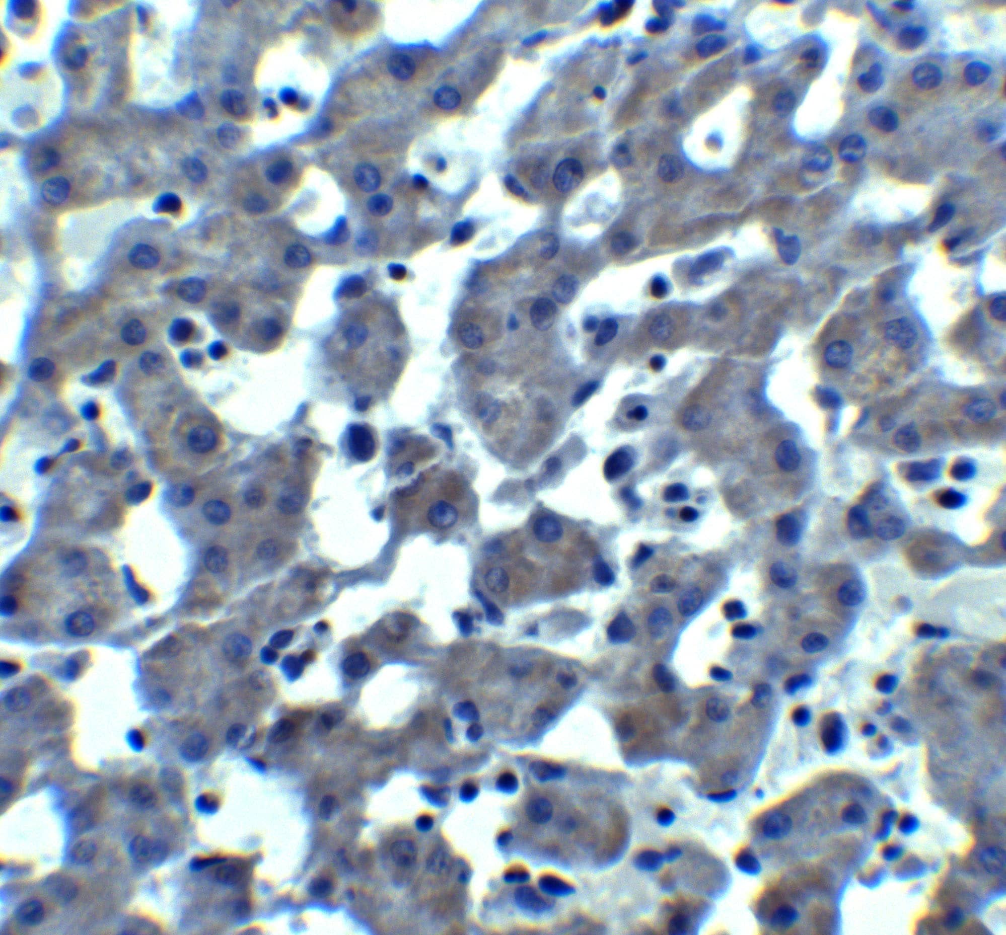 Immunohistochemistry: Trophinin Antibody - BSA Free [NBP2-41320] - Immunohistochemistry of Trophinin in mouse liver tissue with Trophinin antibody at 10 u/ml.