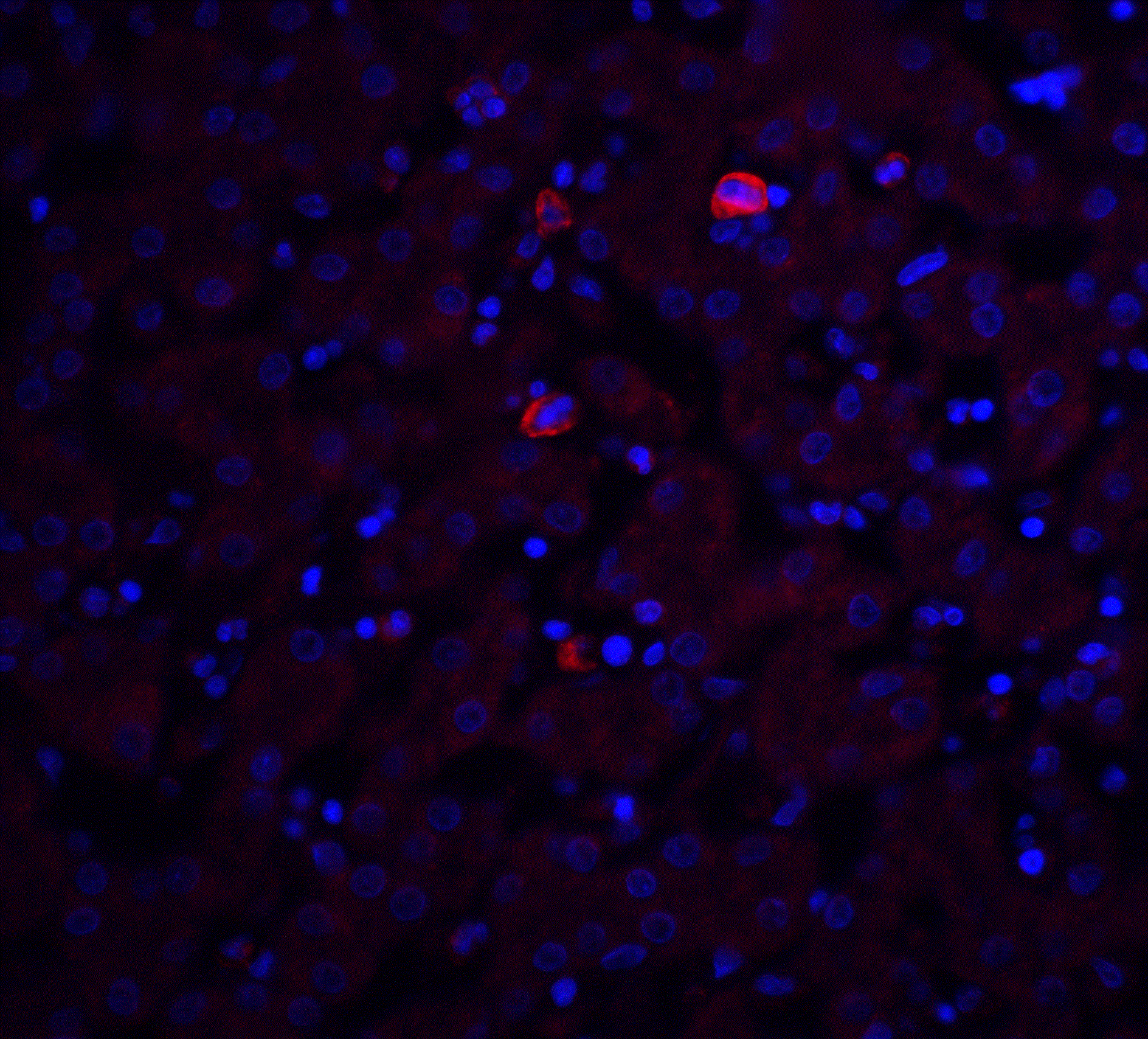 Immunocytochemistry/ Immunofluorescence: Trophinin Antibody - BSA Free [NBP2-41320] - Immunofluorescence of Trophinin in mouse liver tissue with Trophinin antibody at 20 u/ml.Red: Trophinin Antibody   Blue: DAPI staining