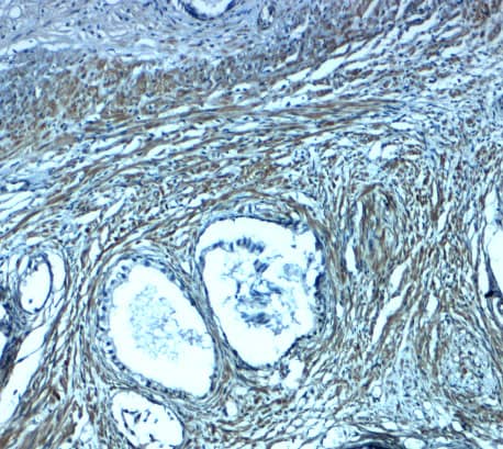 Immunohistochemistry: TMEPAI Antibody - BSA Free [NBP2-41321] - Immunohistochemistry of TMEPAI in human prostate tissue with TMEPAI antibody at 2.5 ug/ml.