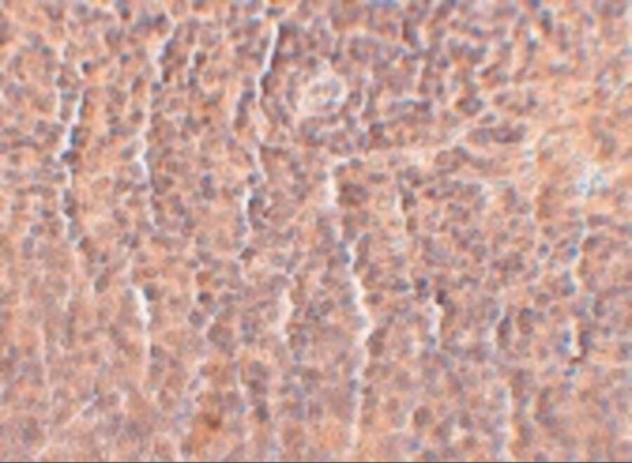 Immunohistochemistry: ORAI3 Antibody (2H2G9) - BSA Free [NBP2-41326] - Immunohistochemistry of ORAI3 in rat spleen tissue with ORAI3 antibody at 2.5 ug/mL.