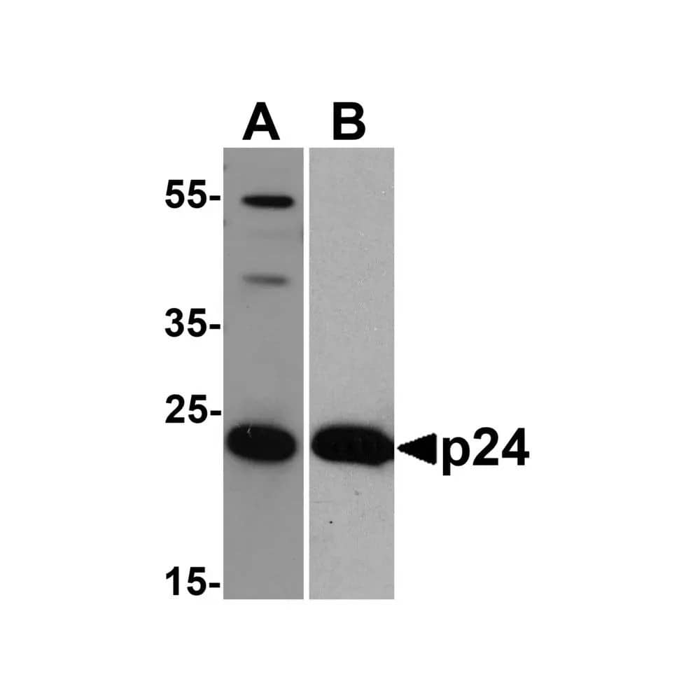 Western Blot: HIV-1 Gag p24 Antibody (8G9) - BSA Free [NBP2-41336] - Western blot analysis of 20 ng of (A) viral p24 and (B) recombinant p24 with anti-HIV-1 Gag p24 antibody NBP2-41336 at (A) 0.5 ug/mL and (B) 0.2 ug/mL, respectively.