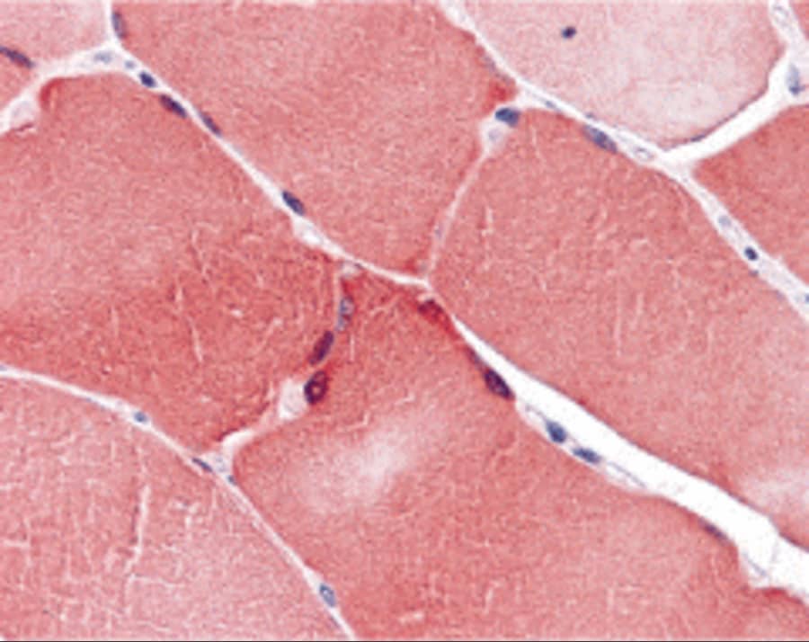 Immunohistochemistry: ARC/NOL3 Antibody - BSA Free [NBP2-41753] - Immunohistochemistry of ARC/NOL3 in human skeletal muscle with ARC/NOL3 antibody at 5 u/mL.