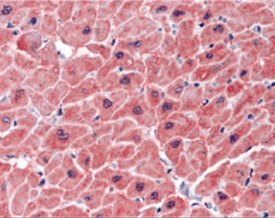 Immunohistochemistry: ARC/NOL3 Antibody - BSA Free [NBP2-41753] - Immunohistochemistry of ARC/NOL3 in human heart tissue with ARC/NOL3 antibody at 5 u/mL.