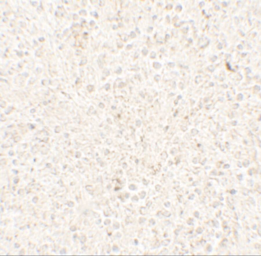 Immunohistochemistry: COMMD7 Antibody - BSA Free [NBP2-42124] - Immunohistochemistry of COMMD7 in human spleen tissue with COMMD7 antibody at 5 u/mL.