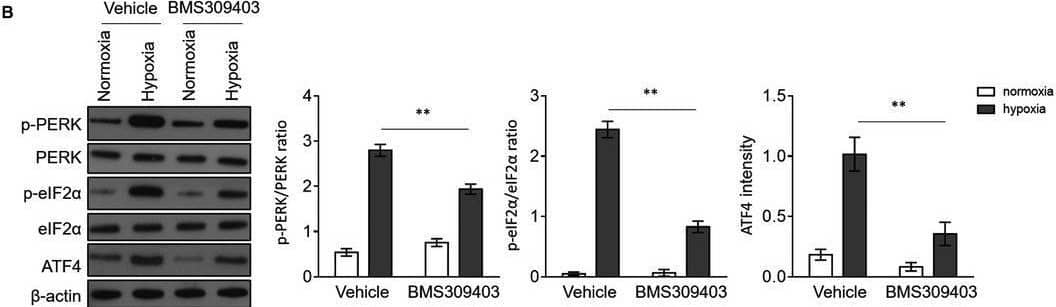 FABP4 inhibitor BMS309403 attenuates ER stress in cardiomyocytes exposed to hypoxia. (A, B) H9c2 cardiomyocytes were cultured under normoxia or hypoxia condition for 24 h in the presence or absence of 50 uM BMS309403. The protein expressions of GPR78, CHOP and caspase‐12 (A), and p‐PERK, PERK, p‐eIF2 alpha , eIF2 and ATF4 (B) were determined by Western blot analysis.  beta ‐actin is the internal control. The quantification analysis of protein expression is shown in the right. Student's t test (n = 3). **, P < 0.01 Image collected and cropped by CiteAb from the following open publication (//pubmed.ncbi.nlm.nih.gov/32896039), licensed under a CC-BY license. Not internally tested by Novus Biologicals.