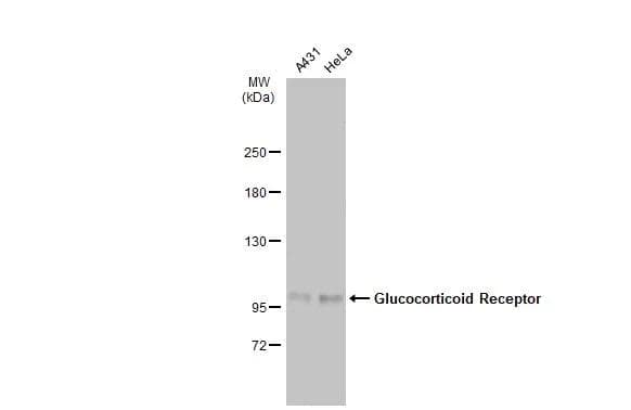 Various whole cell extracts (30 ug) were separated by 5% SDS-PAGE, and the membrane was blotted with Glucocorticoid Receptor antibody (NBP2-42221) diluted at 1:1000. The HRP-conjugated anti-rabbit IgG antibody  was used to detect the primary antibody. 