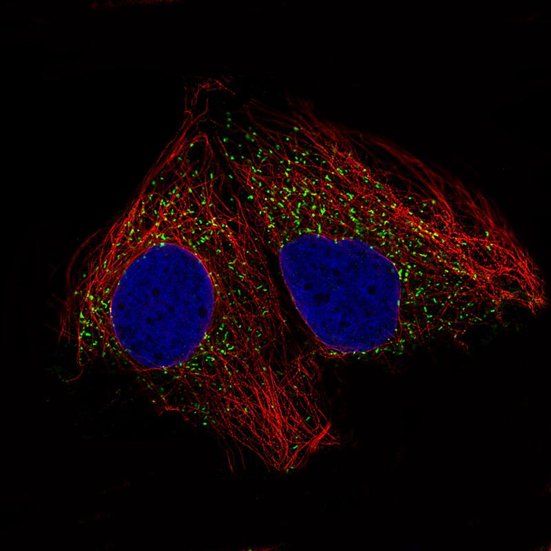 Staining of CACO-2 cells, showing specific staining in peroxisomes in green. Microtubule- and nuclear probes are visualized in red and blue, respectively (where available).