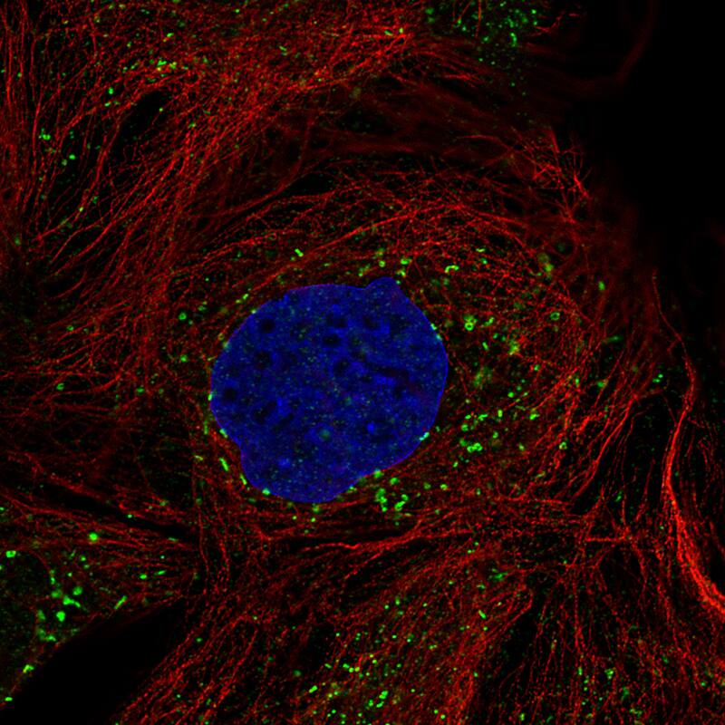Staining of CACO-2 cells, showing specific staining in peroxisomes in green. Microtubule- and nuclear probes are visualized in red and blue, respectively (where available).