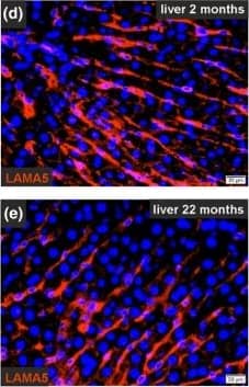 Altered ECM protein gene expression in liver tissue during aging. (a) Hierarchical cluster analysis of differentially expressed genes in whole liver tissue from 2‐month‐old and 22‐month‐old rats. (b) Scatter plot of gene expression of whole liver tissue from both age groups (n = 3 per age group, fold change > 2, p < .05, ANOVA). (c) Expression analyses of genes encoding for ECM proteins by qPCR. Mean expression of liver tissue samples from young rats was set to 100% (n = 8–10 for 2‐month‐old and n = 8–9 for 22‐month‐old rats, *p < .05). Immunofluorescence analysis of liver tissue sections from 2‐month‐old and 22‐month‐old rats (n = 3) with antibodies against (d, e) LAMA5, (f, g) COL1, and (h, i) COL4 (red). Cell nuclei were stained with DAPI (blue; scale bars: 20 um). (j) Proteome analysis of decellularized rat liver tissue. Mean intensities of samples from young rats were set to 100% (n = 3, *p < .05). (c, j) Data are presented as means +/- SEM Image collected and cropped by CiteAb from the following open publication (//pubmed.ncbi.nlm.nih.gov/32157808), licensed under a CC-BY license. Not internally tested by Novus Biologicals.