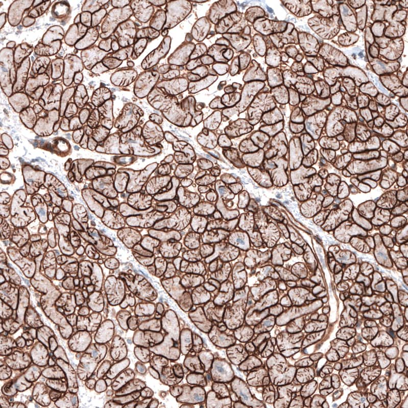 Staining of human heart muscle shows strong positivity in basement membrane of cardiomyocytes.
