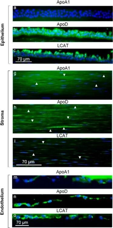 Immunostaining of apolipoprotein (Apo)A1, ApoD, and lecithin:cholesterol acyltransferase (LCAT) in the human central cornea. Frozen sections from an individual cornea were incubated at 4 C with either anti-ApoA1 (a,g,m), ApoD (b,h,n) or LCAT (c,i,o) antibodies (green). Nuclei were stained blue with DAPI. Control sections (right panel) were incubated with the same concentrations of either rabbit IgG (d,f,j,l,p,r) or goat IgG (e,k,q). Antibodies were detected as described in the Materials and Methods. The epithelium, stromal keratocytes, and endothelium showed staining of ApoD (b,h,n) and LCAT (c,i,o). ApoA1 was detected in the stromal keratocytes and endothelium (g,m), but not in the epithelium. Arrowheads indicate some of the immunolabeled keratocytes. Image collected and cropped by CiteAb from the following open publication (//pubmed.ncbi.nlm.nih.gov/31779197), licensed under a CC-BY license. Not internally tested by Novus Biologicals.