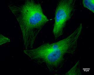 Cofilin 1 antibody [GT567] detects Cofilin 1 protein at cytoplasm by immunofluorescent analysis.Sample: HeLa cells were fixed in 4% paraformaldehyde at RT for 10 min.Green: Cofilin 1 protein stained by Cofilin 1 antibody [GT567] (NBP2-42828) diluted at 1:300.Blue: Hoechst 33342 staining.Scale bar = 10 um. 