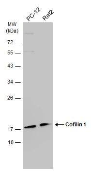 Various whole cell extracts (30 ug) were separated by 12% SDS-PAGE, and the membrane was blotted with Cofilin 1 antibody [GT567] (NBP2-42828) diluted at 1:1000. The HRP-conjugated anti-mouse IgG antibody  was used to detect the primary antibody. 