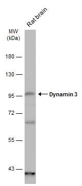 Western Blot: Dynamin 3 Antibody [NBP2-42836] - Rat tissue extract (50 ug) was separated by 7.5% SDS-PAGE, and the membrane was blotted with Dynamin 3 antibody (NBP2-42836) diluted at 1:1000. The HRP-conjugated anti-rabbit IgG antibody  was used to detect the primary antibody.