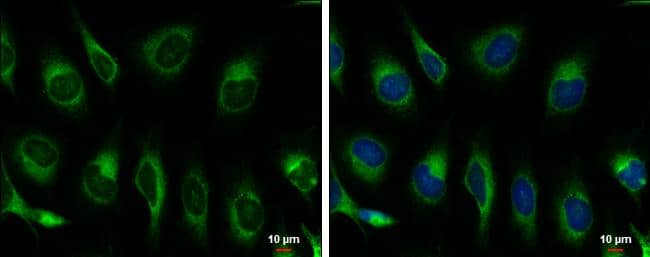 Hspa5 antibody detects Hspa5 protein at endoplasmic reticulum by immunofluorescent analysis.Sample: HeLa cells were fixed in ice-cold MeOH for 5 min.Green: Hspa5 protein stained by Hspa5 antibody (NBP2-42848) diluted at 1:500.Blue: Hoechst 33342 staining.Scale bar = 10 um. 