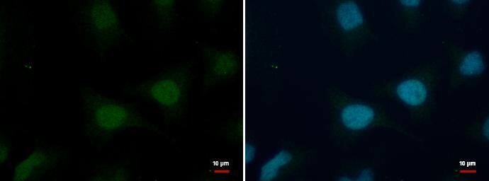 Histone H2B antibody detects Histone H2B protein at nucleus by immunofluorescent analysis. Sample: HeLa cells were fixed in 4% paraformaldehyde/PBS for 15 min.Green: Histone H2B protein stained by Histone H2B antibody (NBP2-42854) diluted at 1:500.Blue: Hoechst 33342 staining. 