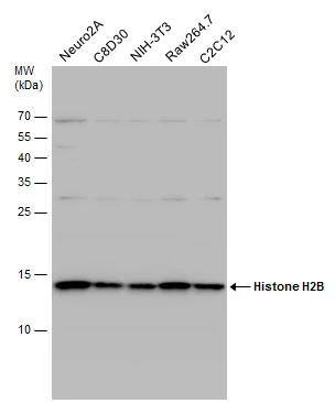 Various whole cell extracts (30 ug) were separated by 15% SDS-PAGE, and the membrane was blotted with Histone H2B antibody (NBP2-42854) diluted at 1:5000. The HRP-conjugated anti-rabbit IgG antibody  was used to detect the primary antibody. 