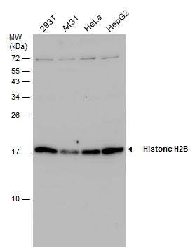 Various whole cell extracts (30 ug) were separated by 15% SDS-PAGE, and the membrane was blotted with Histone H2B antibody (NBP2-42854) diluted at 1:1000. The HRP-conjugated anti-rabbit IgG antibody  was used to detect the primary antibody. 