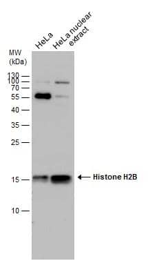 HeLa whole cell and nuclear extracts (30 ug) were separated by 15% SDS-PAGE, and the membrane was blotted with Histone H2B antibody (NBP2-42855) diluted at 1:1000. 
