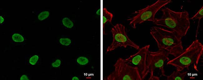Histone H4 (acetyl Lys16) antibody [GT1271] detects Histone H4 (acetyl Lys16) protein at nucleus by immunofluorescent analysis.Sample: HeLa cells were fixed in 4% paraformaldehyde at RT for 15 min.Green: Histone H4 (acetyl Lys16) protein stained by Histone H4 (acetyl Lys16) antibody [GT1271] (NBP2-42858) diluted at 1:500.Red: phalloidin, a cytoskeleton marker, diluted at 1:200.Blue: Hoechst 33342 staining.Scale bar = 10 um. 