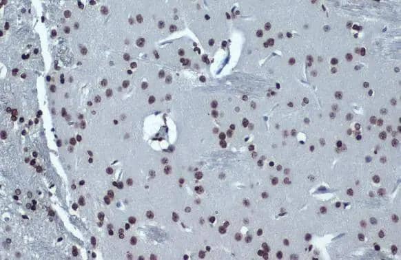 Histone H4K16ac (Acetyl Lys16) antibody [GT1271] detects Histone H4K16ac (Acetyl Lys16) protein at nucleus by immunohistochemical analysis.Sample: Paraffin-embedded rat brain.Histone H4K16ac (Acetyl Lys16) stained by Histone H4K16ac (Acetyl Lys16) antibody [GT1271] (NBP2-42858) diluted at 1:500.Antigen Retrieval: Citrate buffer, pH 6.0, 15 min 
