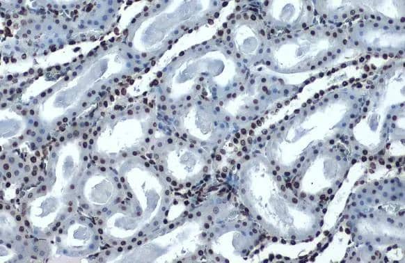 Histone H4K16ac (Acetyl Lys16) antibody [GT1271] detects Histone H4K16ac (Acetyl Lys16) protein at nucleus by immunohistochemical analysis.Sample: Paraffin-embedded rat kidney.Histone H4K16ac (Acetyl Lys16) stained by Histone H4K16ac (Acetyl Lys16) antibody [GT1271] (NBP2-42858) diluted at 1:500.Antigen Retrieval: Citrate buffer, pH 6.0, 15 min 