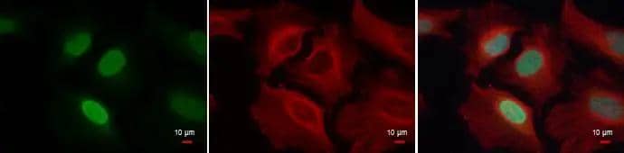 Histone H4 (mono methyl Lys20) antibody detects Histone H4 (mono methyl Lys20) protein at nucleus by immunofluorescent analysis.Sample: HeLa cells were fixed in 4% paraformaldehyde at RT for 15 min.Green: Histone H4 (mono methyl Lys20) protein stained by Histone H4 (mono methyl Lys20) antibody (NBP2-42859) diluted at 1:500.Red: alpha Tubulin antibody [GT114], a cytoskeleton marker, stained by diluted at 1:500.Blue: Hoechst 33342 staining. 