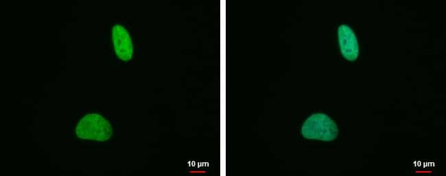Histone H4 (di-Methyl Lys20) antibody [GT282] detects Histone H4 (di-Methyl Lys20) protein at nucleus by immunofluorescent analysis.Sample: HeLa cells were fixed in 4% paraformaldehyde at RT for 15 min.Green: Histone H4 (di-Methyl Lys20) protein stained by Histone H4 (di-Methyl Lys20) antibody [GT282] (NBP2-42860) diluted at 1:500.Blue: Hoechst 33342 staining. 