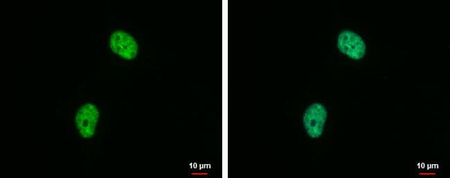 Histone H4 (di-Methyl Lys20) antibody [GT1851] detects Histone H4 (di-Methyl Lys20) protein at nucleus by immunofluorescent analysis.Sample: HeLa cells were fixed in 4% paraformaldehyde at RT for 15 min.Green: Histone H4 (di-Methyl Lys20) protein stained by Histone H4 (di-Methyl Lys20) antibody [GT1851] (NBP2-42861) diluted at 1:500.Blue: Hoechst 33342 staining. 