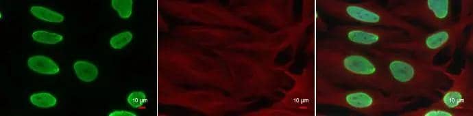 Histone H4 (acetyl Lys8) antibody detects Histone H4 (acetyl Lys8) protein at nucleus by immunofluorescent analysis.Sample: HeLa cells were fixed in 4% paraformaldehyde at RT for 15 min.Green: Histone H4 (acetyl Lys8) protein stained by Histone H4 (acetyl Lys8) antibody (NBP2-42863) diluted at 1:500.Red: alpha Tubulin antibody [GT114], a cytoskeleton marker, stained by diluted at 1:500.Blue: Hoechst 33342 staining. 