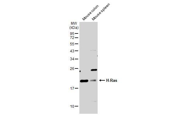 Various tissue extracts (50 ug) were separated by 12% SDS-PAGE, and the membrane was blotted with H-Ras antibody (NBP2-42864) diluted at 1:2000. The HRP-conjugated anti-rabbit IgG antibody  was used to detect the primary antibody. 