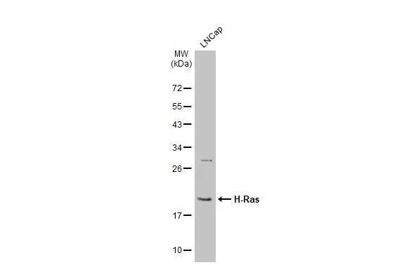 Whole cell extract (30 ug) was separated by 12% SDS-PAGE, and the membrane was blotted with H-Ras antibody (NBP2-42864) diluted at 1:1000. The HRP-conjugated anti-rabbit IgG antibody  was used to detect the primary antibody. 