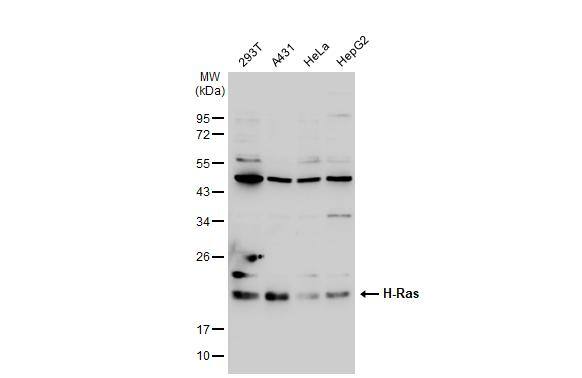 Various whole cell extracts (30 ug) were separated by 12% SDS-PAGE, and the membrane was blotted with H-Ras antibody (NBP2-42864) diluted at 1:2000. The HRP-conjugated anti-rabbit IgG antibody  was used to detect the primary antibody. 