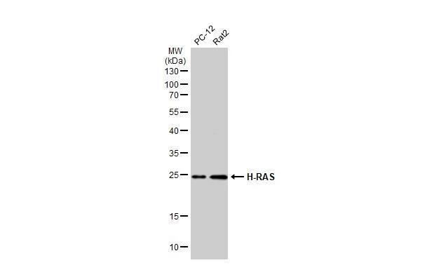 Various whole cell extracts (30 ug) were separated by 12% SDS-PAGE, and the membrane was blotted with H-RAS antibody (NBP2-42864) diluted at 1:1000. The HRP-conjugated anti-rabbit IgG antibody  was used to detect the primary antibody. 