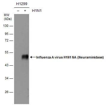 Non-infected (-) and infected (+) H1299 whole cell extracts (5 ug) were separated by 10% SDS-PAGE, and the membrane was blotted with Influenza A virus H1N1 NA (Neuraminidase) antibody (NBP2-42870) diluted at 1:1000. 