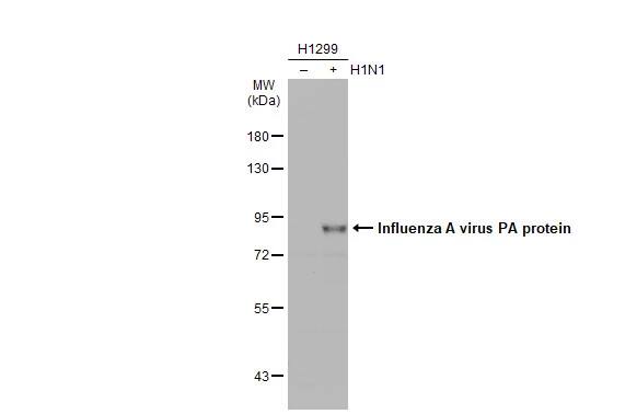 Western Blot: Influenza A H1N1 PA Antibody - (A/Puerto Rico/8/1934) [NBP2-42875] - Non-infected (-) and infected (+) H1299 whole cell extracts (15 ug) were separated by 7.5% SDS-PAGE, and the membrane was blotted with Influenza A H1N1 PA antibody (NBP2-42875) diluted at 1:5000. The HRP-conjugated anti-rabbit IgG antibody  was used to detect the primary antibody.