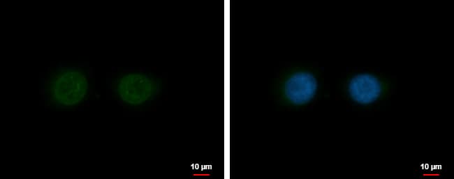 Immunocytochemistry/ Immunofluorescence: Nesprin 2 Antibody [NBP2-42886] - Syne2 antibody [C3], C-term detects Syne2 protein at nucleus by immunofluorescent analysis.Sample: H1299 cells were fixed in 4% paraformaldehyde at RT for 15 min.Green: Syne2 protein stained by Syne2 antibody [C3], C-term (NBP2-42886) diluted at 1:500.Blue: Hoechst 33342 staining.Scale bar = 10 um.