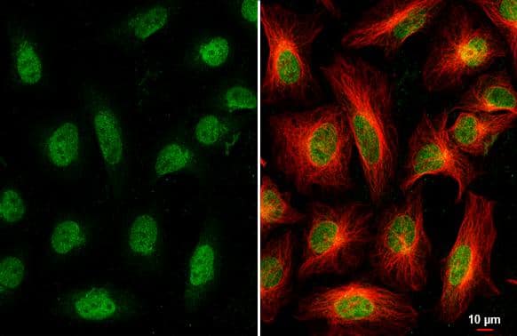 Immunocytochemistry/ Immunofluorescence Nesprin 2 Antibody
