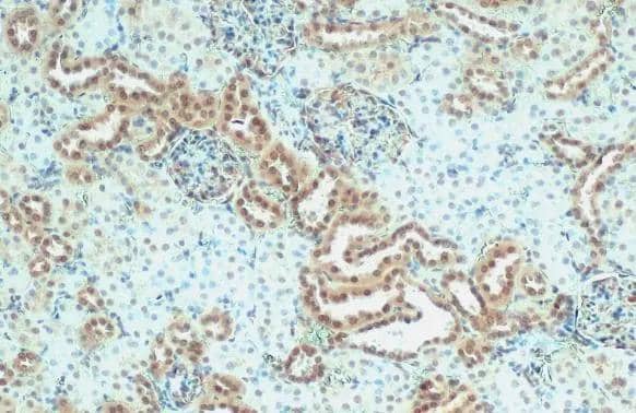 Immunohistochemistry-Paraffin Nesprin 2 Antibody