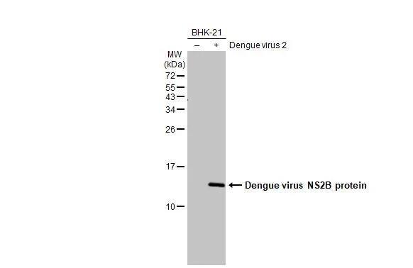 Non-infected (-) and infected (+) BHK-21 whole cell extracts (5 ug) were separated by 15% SDS-PAGE, and the membrane was blotted with Dengue virus NS2B protein antibody (NBP2-42891) diluted at 1:1000. The HRP-conjugated anti-rabbit IgG antibody  was used to detect the primary antibody. 