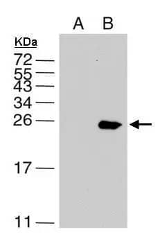 Western Blot: Dengue Virus NS4B Antibody [NBP2-42895] - Sample(15 ug of cell lysate)  A: BHK21  B: DV infected BHK21  10% SDS PAGE  NBP2-42895 diluted at 1:5000 The HRP-conjugated anti-rabbit IgG antibody  was used to detect the primary antibody.