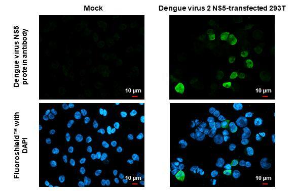 Immunocytochemistry/ Immunofluorescence Dengue Virus NS5 Antibody