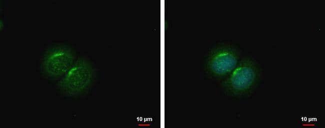 PCOLCE2 antibody detects PCOLCE2 protein at cytoplasm by immunofluorescent analysis.Sample: MCF-7 cells were fixed in ice-cold MeOH for 5 min.Green: PCOLCE2 protein stained by PCOLCE2 antibody (NBP2-42910) diluted at 1:500.Blue: Hoechst 33342 staining. 