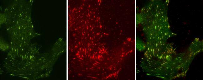 Phosphotyrosine antibody [GT0021] detects Phosphotyrosine protein at cytoplasm by immunofluorescent analysis.Sample: MDA-MB-231 cells were fixed in 4% paraformaldehyde at RT for 15 min.Green: Phosphotyrosine protein stained by Phosphotyrosine antibody [GT0021] (NBP2-42911) diluted at 1:50.Red: paxillin, a cytoskeleton marker, stained by Paxillin antibody  diluted at 1:100. 