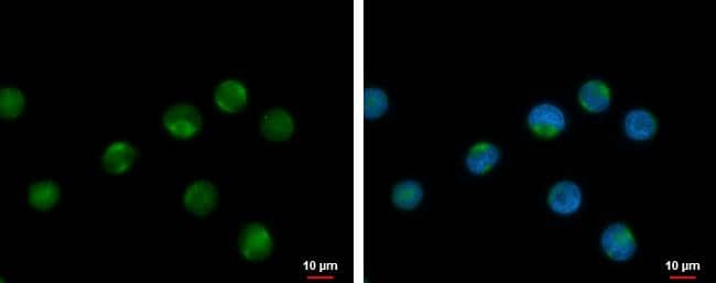 Immunocytochemistry/ Immunofluorescence RPL17P7 Antibody - BSA Free