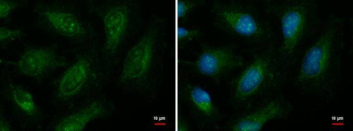 Immunocytochemistry/ Immunofluorescence EXOC8 Antibody - BSA Free