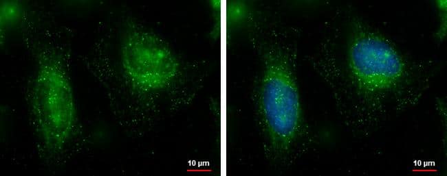 Immunocytochemistry/ Immunofluorescence FAM21C Antibody - BSA Free