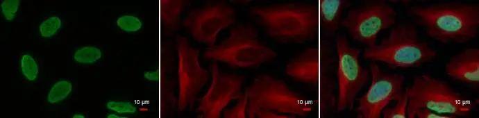 Histone H3 (acetyl Lys18) antibody detects Histone H3 (acetyl Lys18) protein at nucleus by immunofluorescent analysis.Sample: HeLa cells were fixed in 4% paraformaldehyde at RT for 15 min.Green: Histone H3 (acetyl Lys18) protein stained by Histone H3 (acetyl Lys18) antibody (NBP2-43535) diluted at 1:500.Red: alpha Tubulin antibody [GT114], a cytoskeleton marker, stained by diluted at 1:500.Blue: Hoechst 33342 staining. 